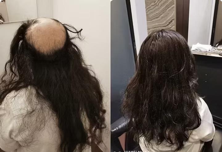 hairspec
